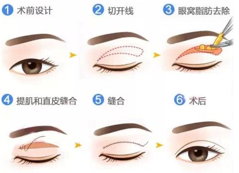 QQ瀏覽器截圖20210908174718.png