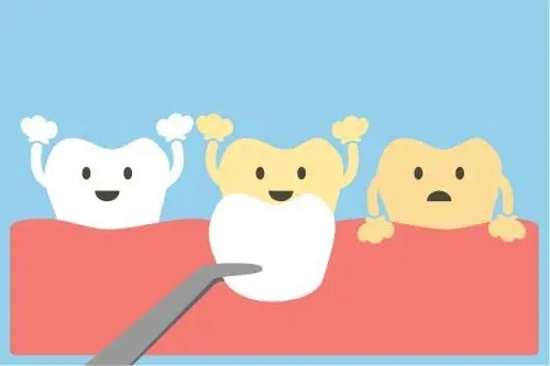 u=3637177709,3908044902&fm=253&fmt=auto&app=138&f=JPEG.webp.jpg u=3637177709,3908044902&fm=253&fmt=auto&app=138&f=JPEG.webp.jpg