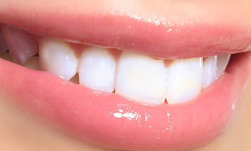 1507098114-o.png 1507098114-o.png