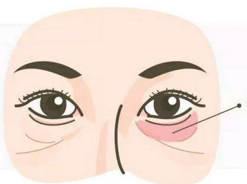 src=http%3A%2F%2Fimg2.soyoung.com%2Ftieba%2Fandroid%2Fpost%2F20190505%2F0%2F58feed485ac350682275dd01