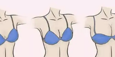 隆胸10.png 隆胸10.png