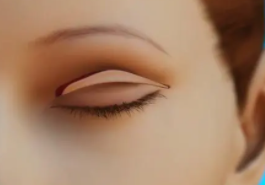 雙眼皮4.png 雙眼皮4.png