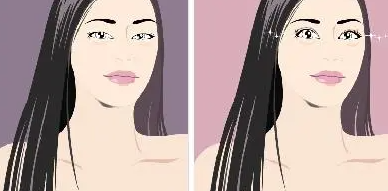 雙眼皮6 (2).png 雙眼皮6 (2).png