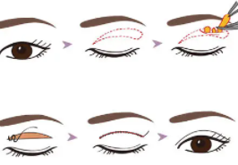 雙眼皮5.png 雙眼皮5.png