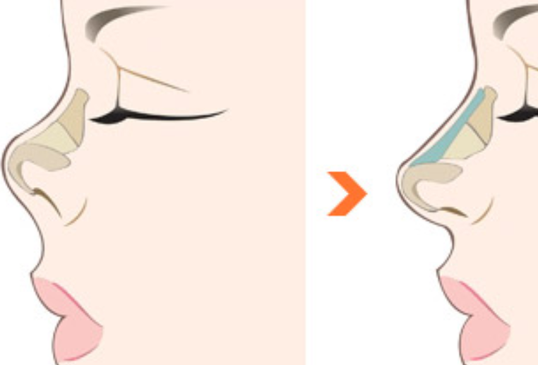 圖片.png 圖片.png