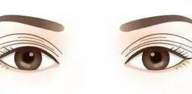 雙眼皮4 (2).png 雙眼皮4 (2).png