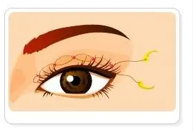 雙眼皮8 (2).png 雙眼皮8 (2).png