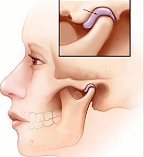 src=http___safe-img.xhscdn.com_bw1_e5d7211a-54e0-4e1e-8659-4fe8917465ad_imageView2_2_w_1080_format_j