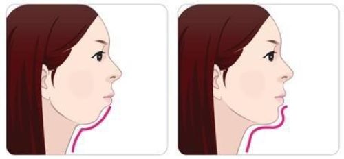 006KMghHly4fj8ggwyccaj30co05w0sq.jpg undefined