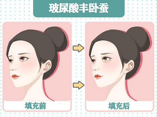 u=1489422120,198596679&fm=30&app=106&f=JPEG_w=640&h=477&s=3AEEFD16672242A8AECDF8